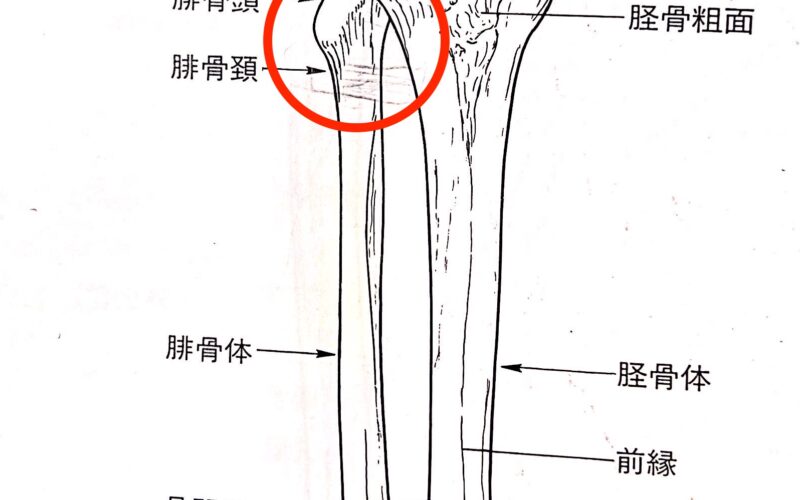 膝の外側痛